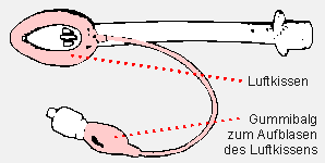 Bild 2: Larynxmaske mit aufblasbarem Luftkissen zur Abdichtung vor dem Kehlkopfeingang