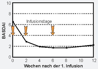 Bild 1: Mittelwert (Medianwert) der Krankheitsaktivitt (Bath Ankylosing Spondylitis Disease Activity Index) vor, whrend und nach der dreimaligen Infusion des TNF-alpha-Blockers Infliximab