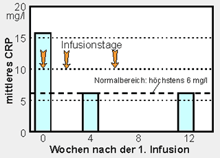 Bild 2: Mittelwert (Median) des Entzndungs-Laborwerts C-reaktives Protein vor, whrend und nach der dreimaligen Infusion des TNF-alpha-Blockers Infliximab