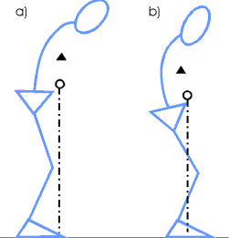 Bild 1: Die Wirbelsulen-Kyphose fhrt zu einer Vorwrts- und Abwrtsverschiebung des Rumpfschwerpunkts (Dreieck) und damit auch des Krperschwerpunkts (Kreissymbol) gegenber der Standflche (a).
Der Patient verndert seine Haltung, um den Schwerpunkt wieder ber die Standflche zu bekommen (b)
