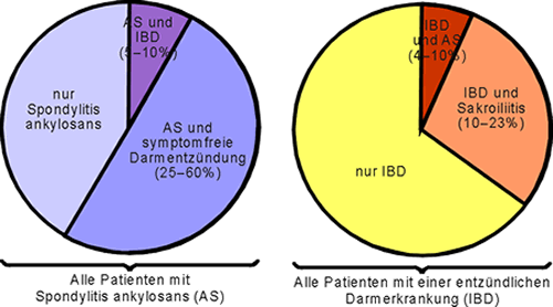 Bild 1: Häufigkeit von entzündlichen
Darmerkrankungen bei der Spondylitis ankylosans und von entzündlichen
Wirbelsäulenerkrankungen bei Morbus Crohn und Colitis ulcerosa